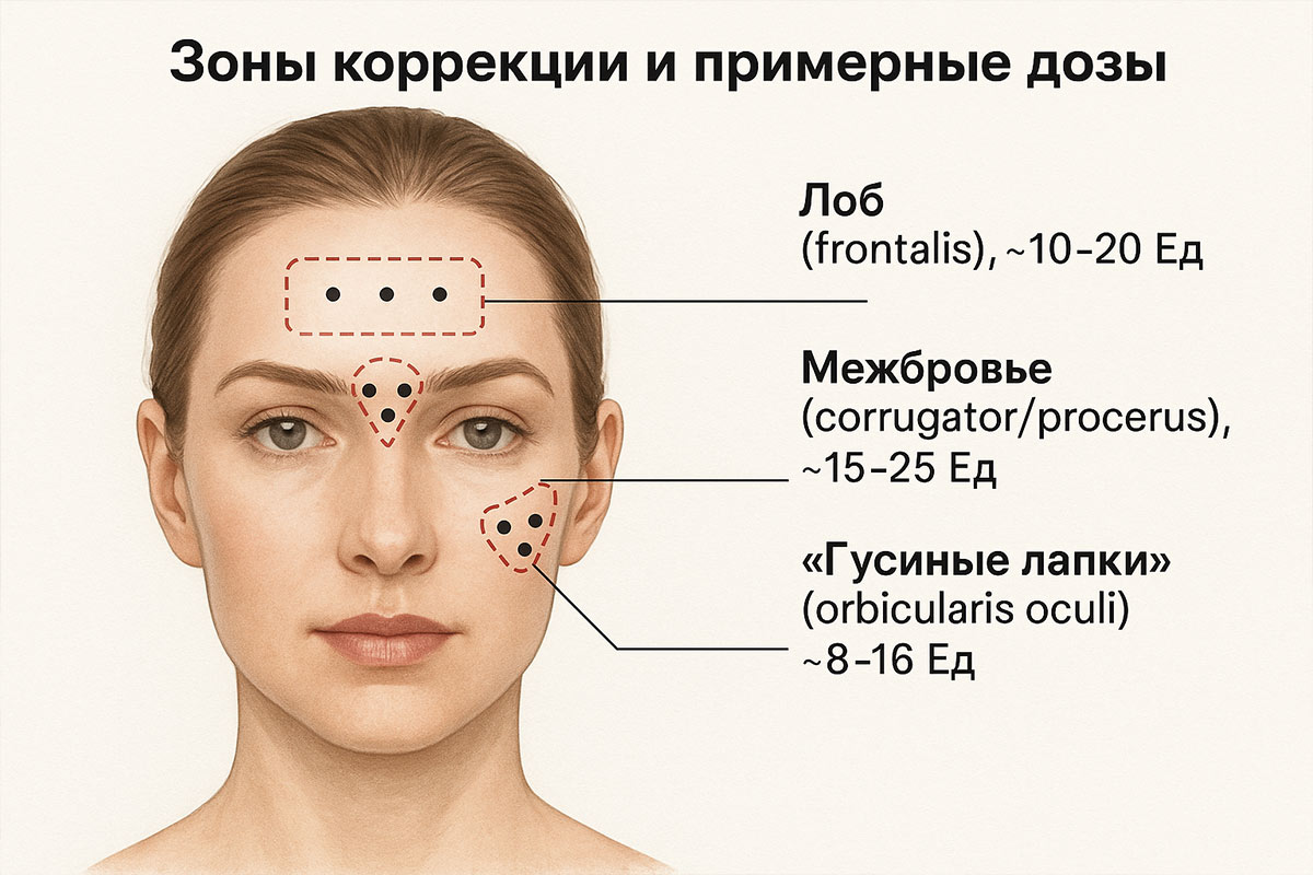 Зоны коррекции и примерные дозы